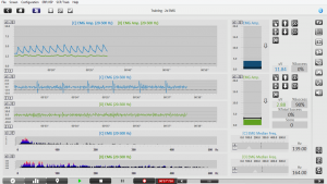 Izom biofeedback EMG