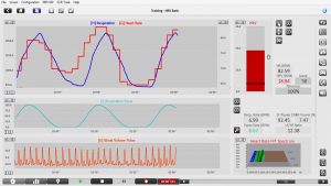 Szívfrekvencia variabilitás biofeedback HRV