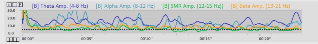 neurofeedback amplitúdó